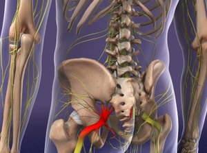 Sciatica Care
