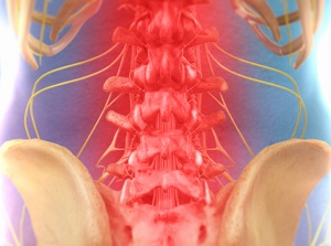 Spinal Decompression